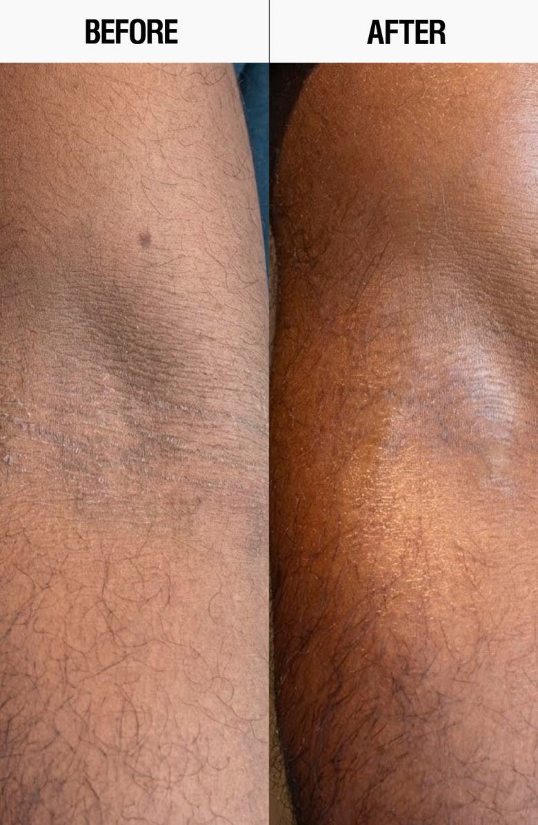 GROWN ALCHEMIST Resurfacing Targeted Body Lotion, Alternate, color,