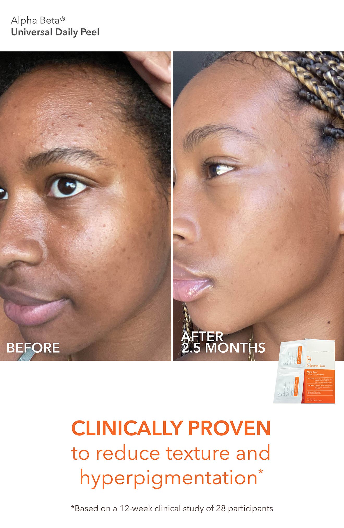 dr dennis alpha beta peel