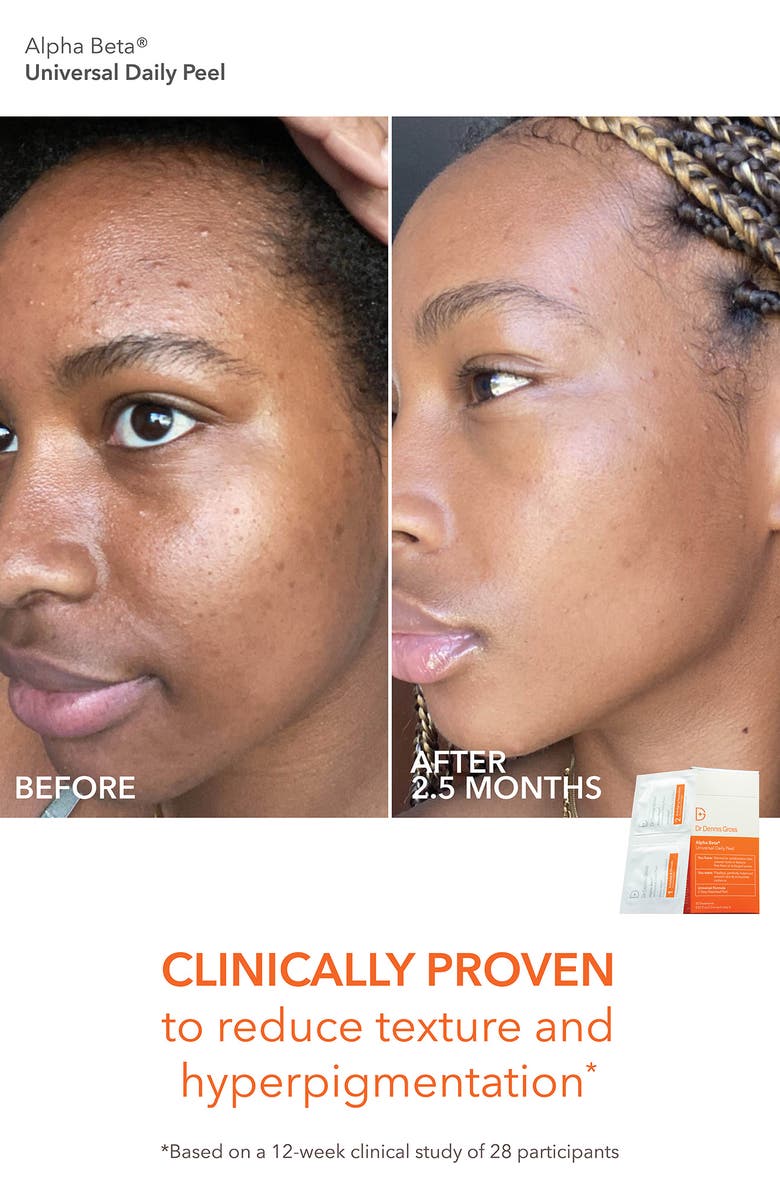 Dr. Dennis Gross Skincare Alpha Beta Daily Peel Vault Set $245 Value, Alternate, color, 