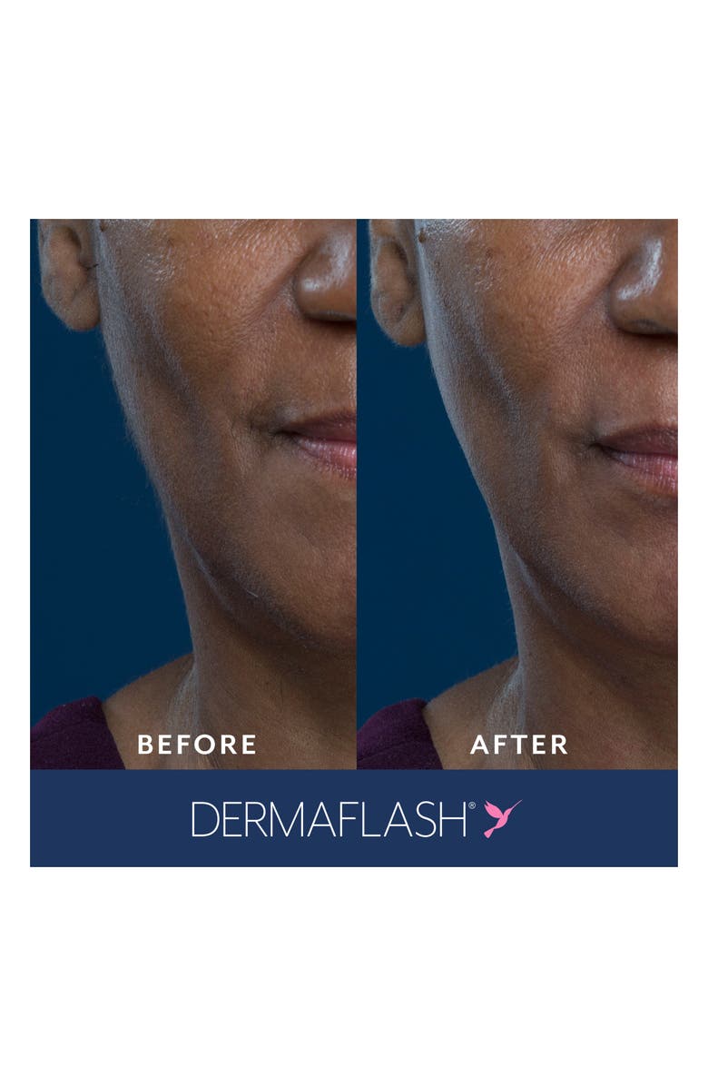 DERMAFLASH ONE Glitter Exfoliation & Peach Fuzz Removal Device, Alternate, color, 