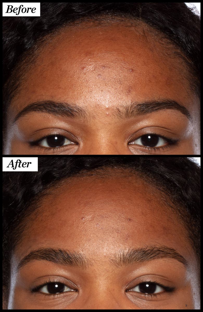 Sunday Riley Good Genes Home & Away Set $184 Value, Alternate, color,