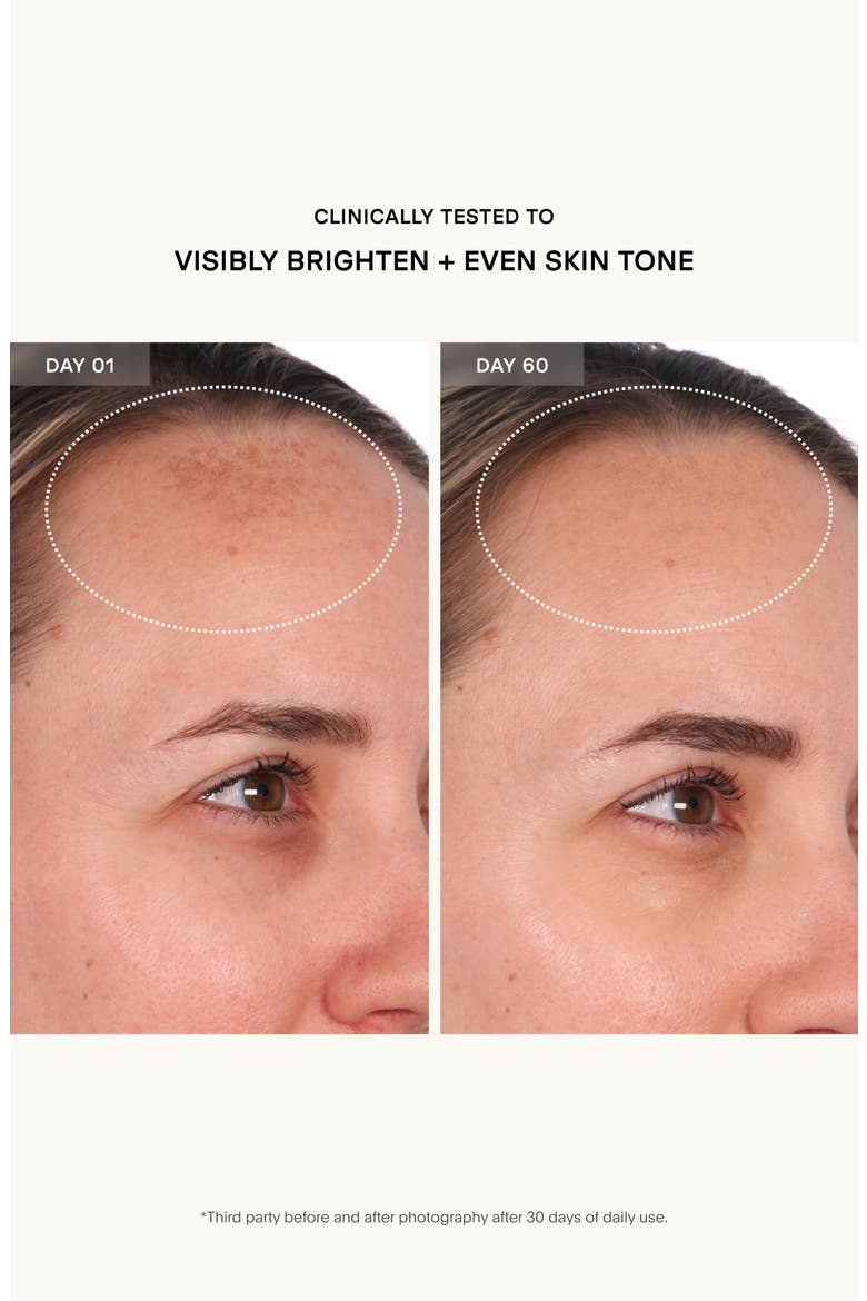 The Resurfacing Compound Skin Care Treatment, Alternate, color, NO COLOR
