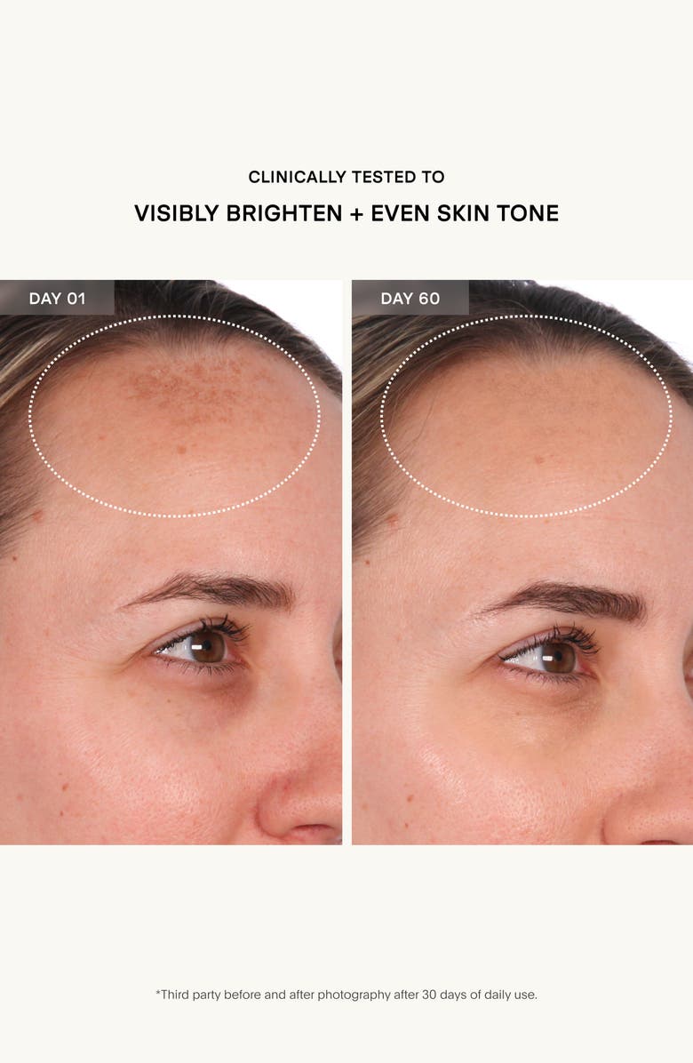 U Beauty The Resurfacing Compound Skin Care Treatment, Alternate, color, 