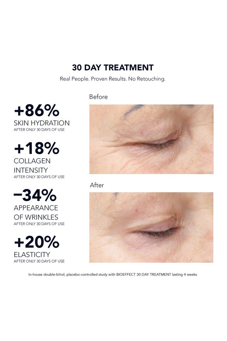 30 Day Treatment Intensive Anti-Aging Serum, Alternate, color, NO COLOR
