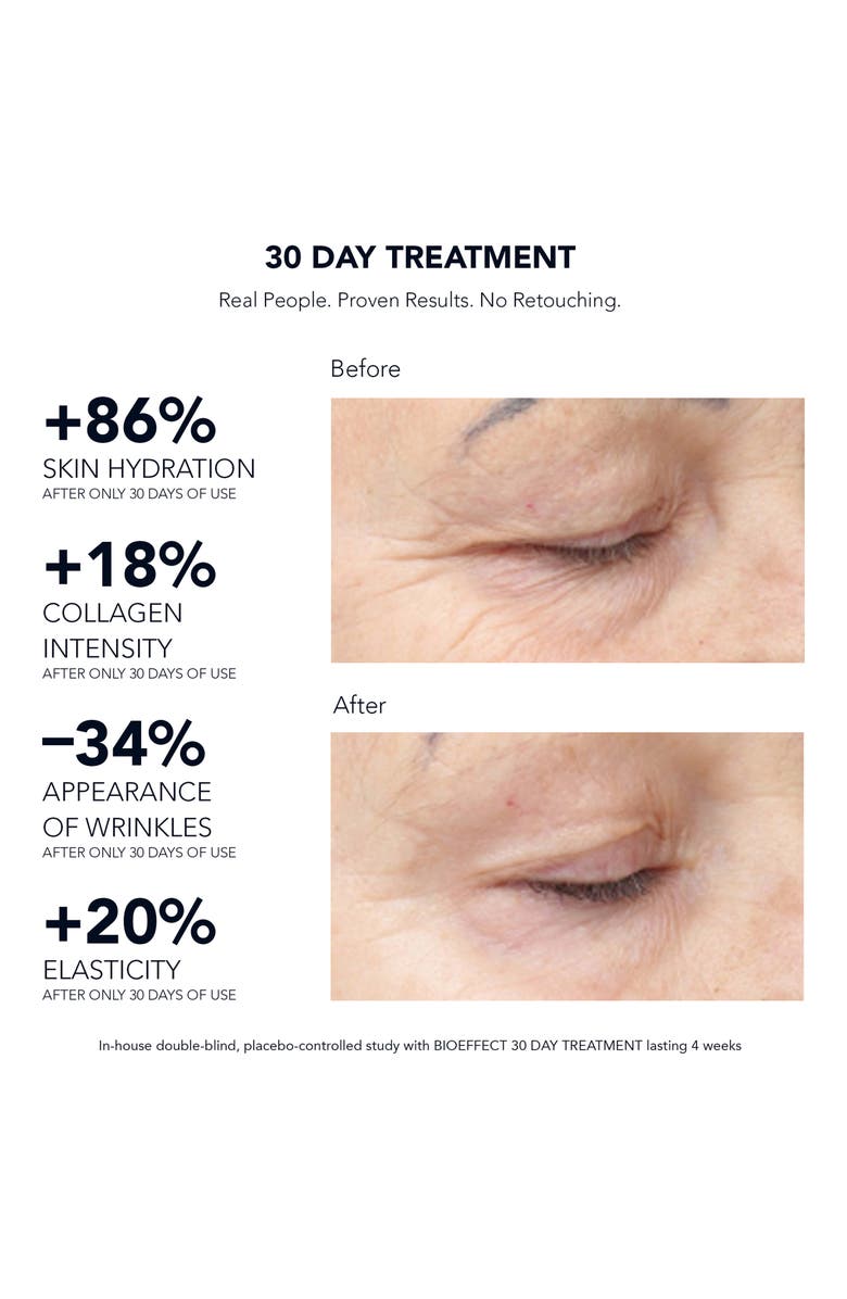 BIOEFFECT 30 Day Treatment Intensive Anti-Aging Serum, Alternate, color,