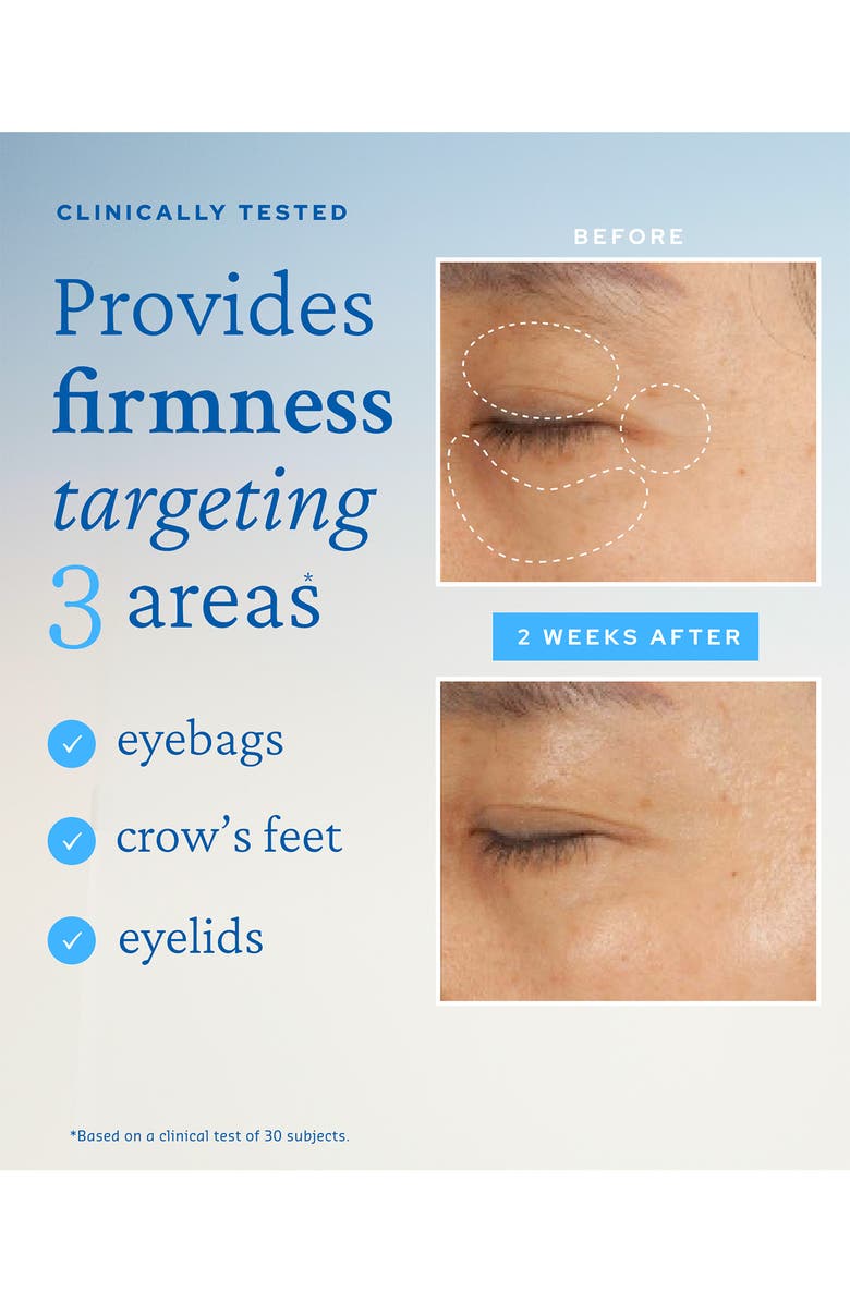 belif Moisturizing Eye Bomb, Alternate, color, 