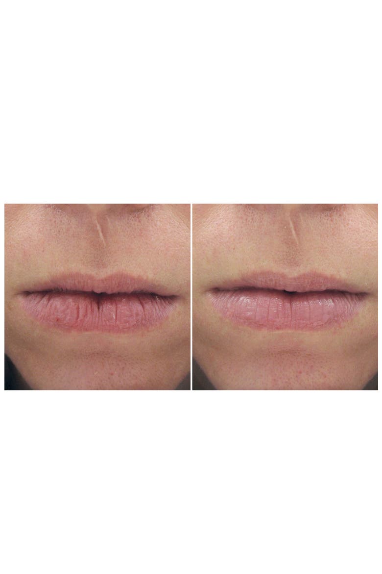 Peptide Lip Therapy, Alternate, color, NO COLOR
