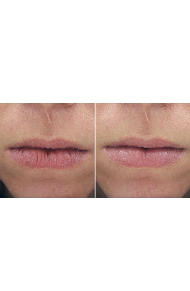 PCA Skin Peptide Lip Therapy, Alternate, color,