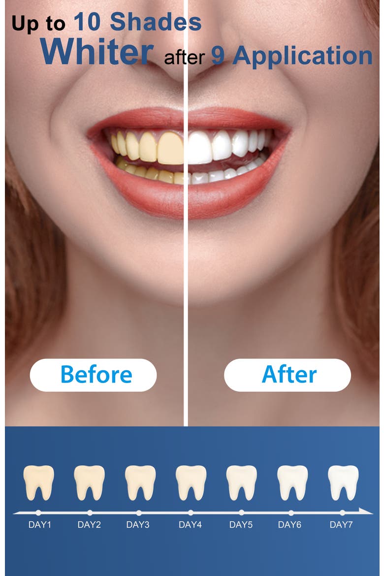 Teeth Whitening Gel Refill Pack, 3 Non-Sensitive Teeth Whitening Gel, Alternate, color, Clear
