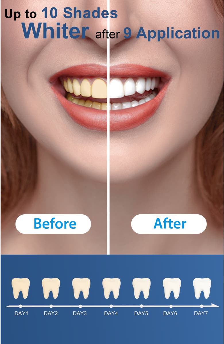 MySmile Teeth Whitening Gel Refill Pack, 3 Non-Sensitive Teeth Whitening Gel, Alternate, color, Clear