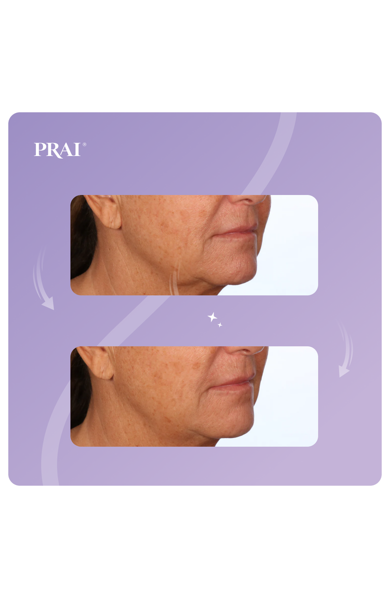 PRAI BEAUTY Ageless Jawline Uplift Serum 30ml, Alternate, color, NO COLOR