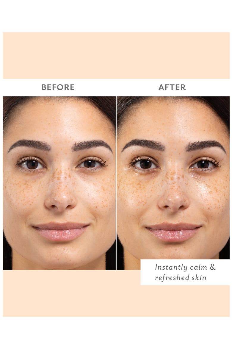 Skin Remedy Calm & Protect Mist, Alternate, color, NO COLOR