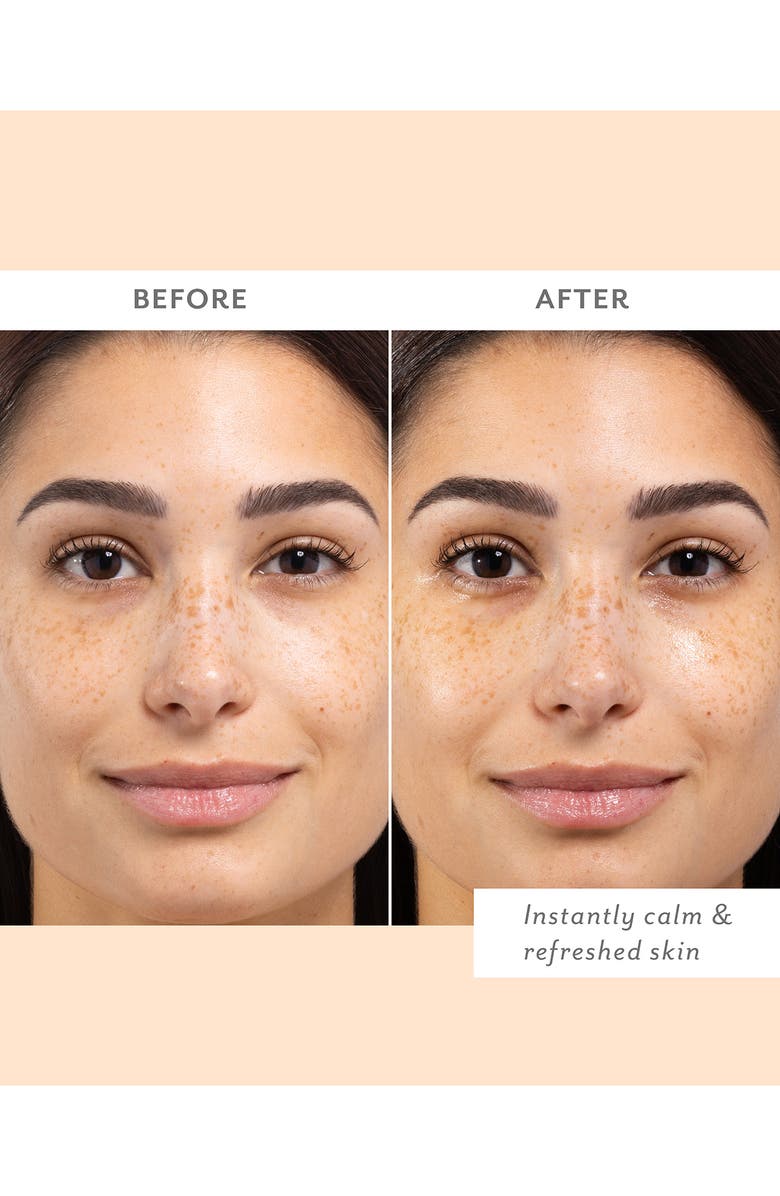 Patchology Skin Remedy Calm & Protect Mist, Alternate, color, 