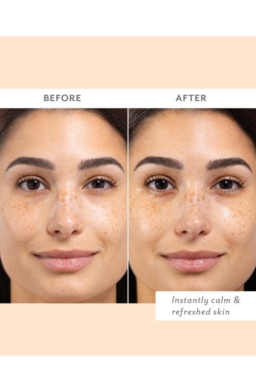 Patchology Skin Remedy Calm & Protect Mist In No Color