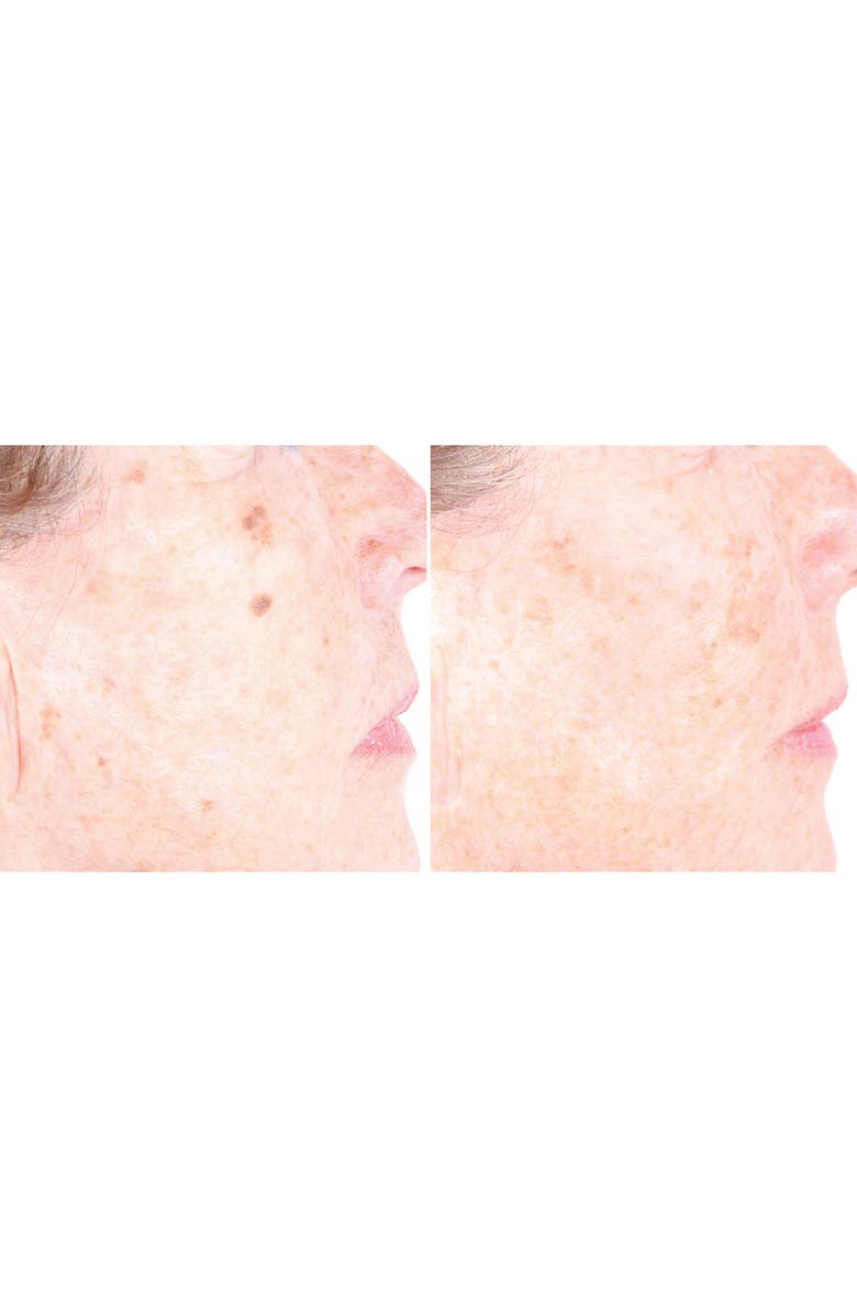 PCA Skin C&E Strength Max Treatment, Alternate, color,