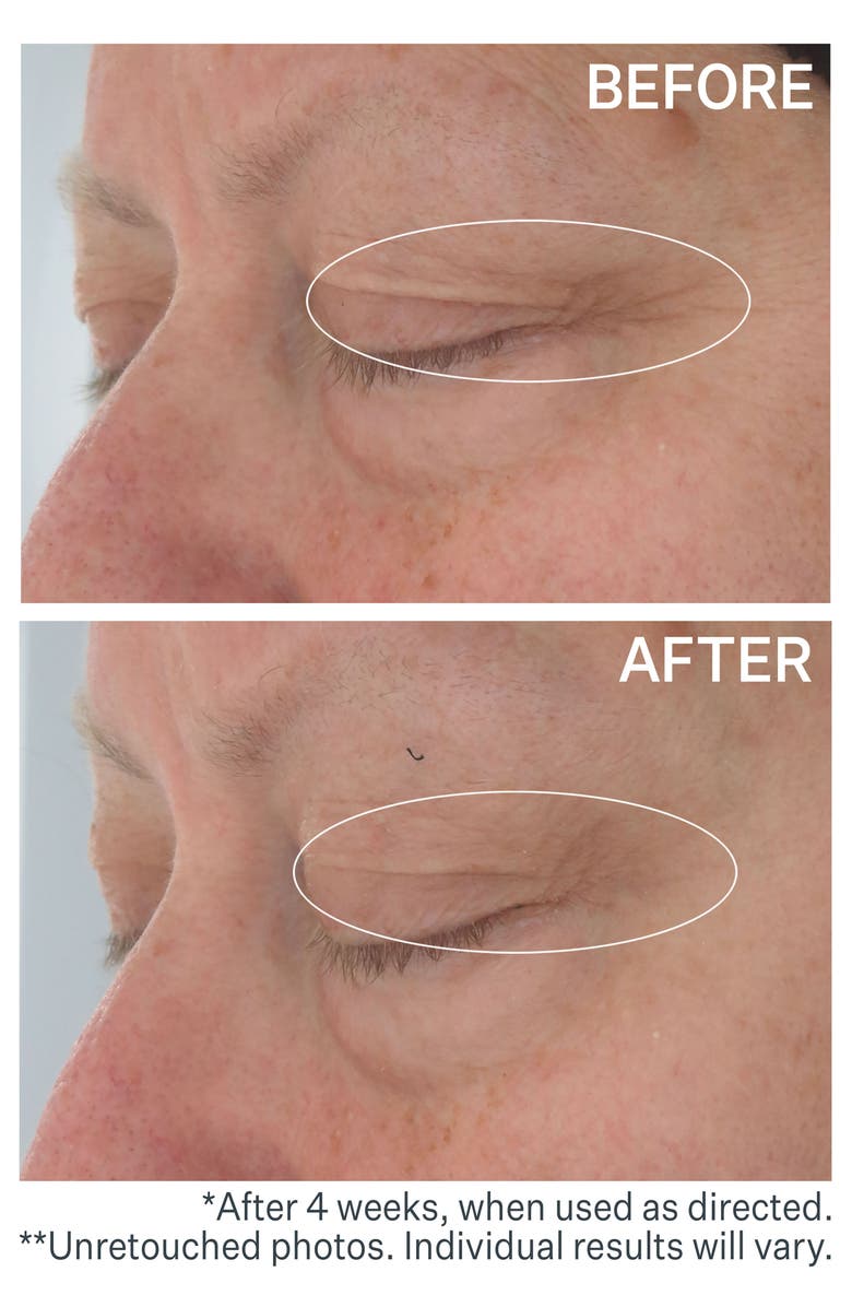 StriVectin<sup>®</sup> Hyaluronic Tripeptide Gel-Cream for Eyes, Alternate, color,