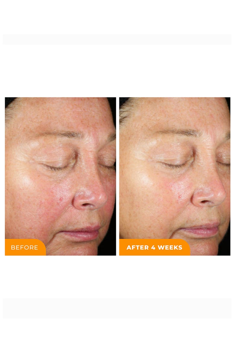 Universal C Skin Refiner Vitamin C Serum + SPF 50 Mineral Sunscreen, Alternate, color, NO COLOR