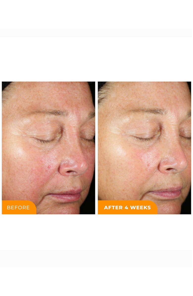 BeautyStat Universal C Skin Refiner Vitamin C Serum + SPF 50 Mineral Sunscreen, Alternate, color, 