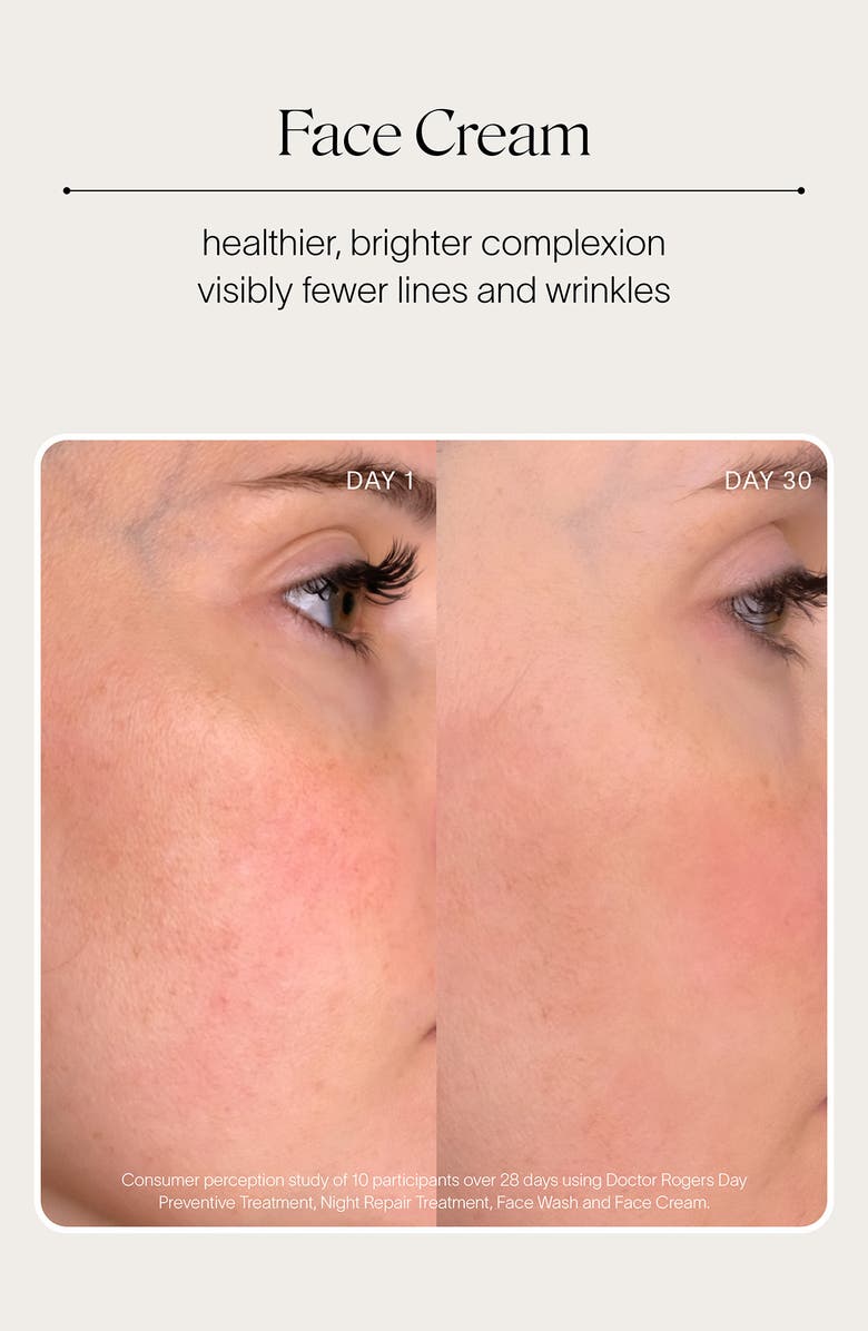 DOCTOR ROGERS Starter Skin Care Set, Alternate, color, 