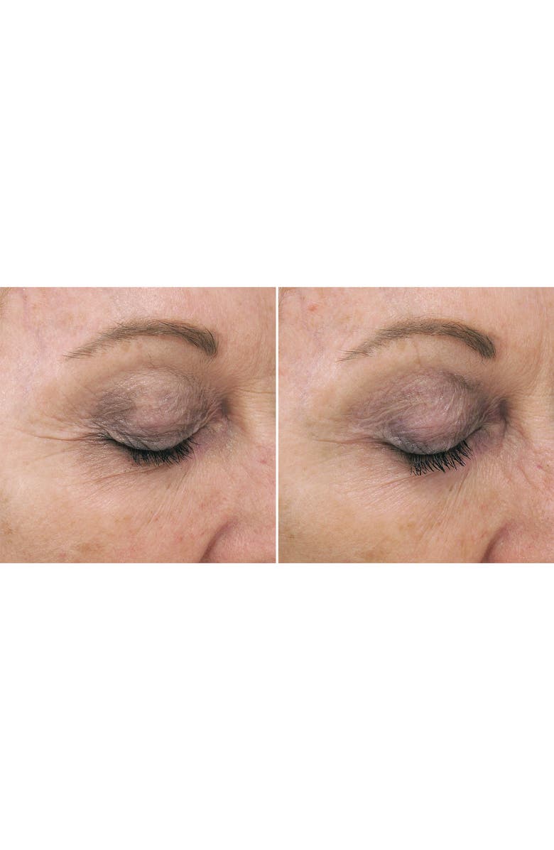 PCA Skin Rejuvenating Serum, Alternate, color, 