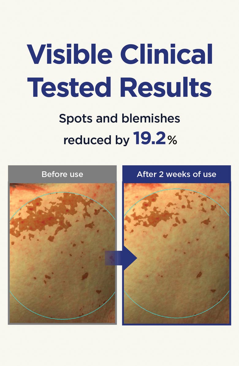 CKD Vita C Teca Triple Blemish Patch - 60 Count, Alternate, color, 