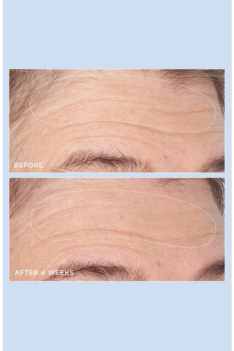 Cold Plasma Plus+ Advanced Hydrating Complex Moisturizer, Alternate, color, NO COLOR