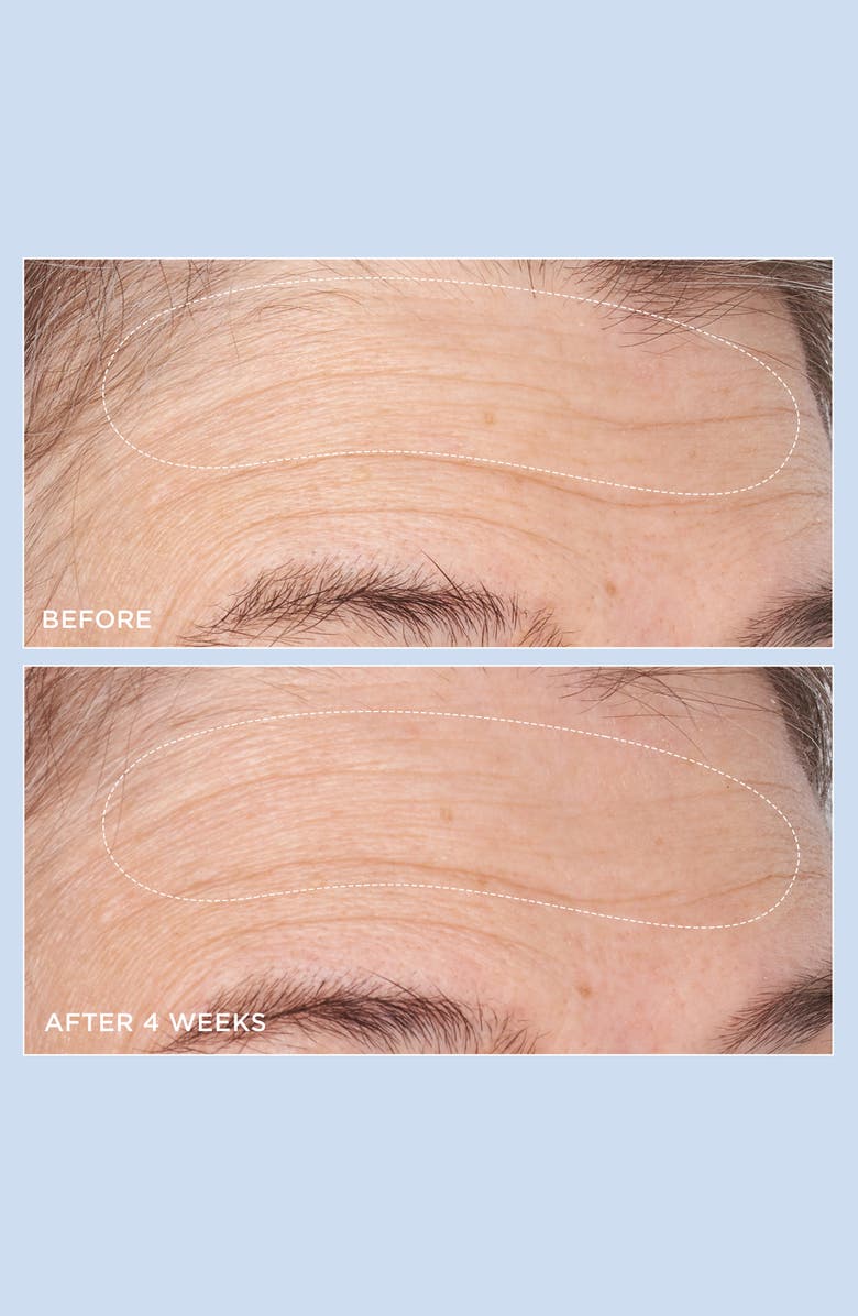 Perricone MD Cold Plasma Plus+ Advanced Hydrating Complex Moisturizer, Alternate, color,