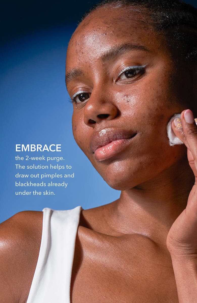 Dr. Dennis Gross Skincare Alpha Beta<sup>®</sup> 2% BHA+ Breakout Solution, Alternate, color, 