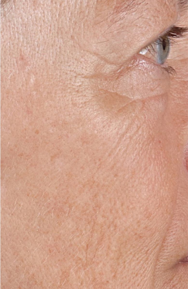 Perricone MD High Potency Hyaluronic Intensive Hydrating Serum, Alternate, color,