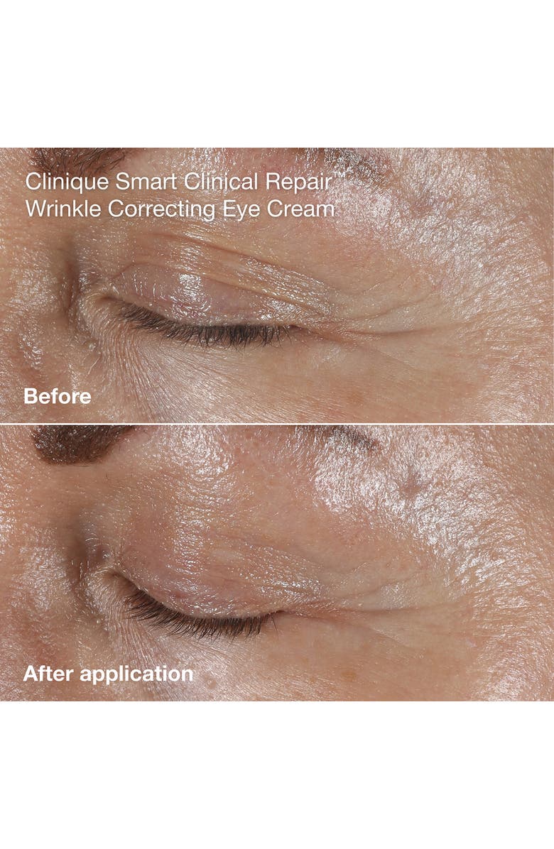 Clinique A+ De-Agers Anti-Aging Skin Care Set (Limited Edition) $173 Value, Alternate, color, 