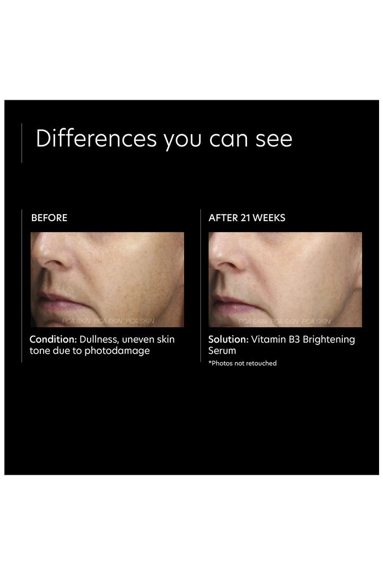 Vitamin B3 Brightening Serum, Alternate, color, NO COLOR