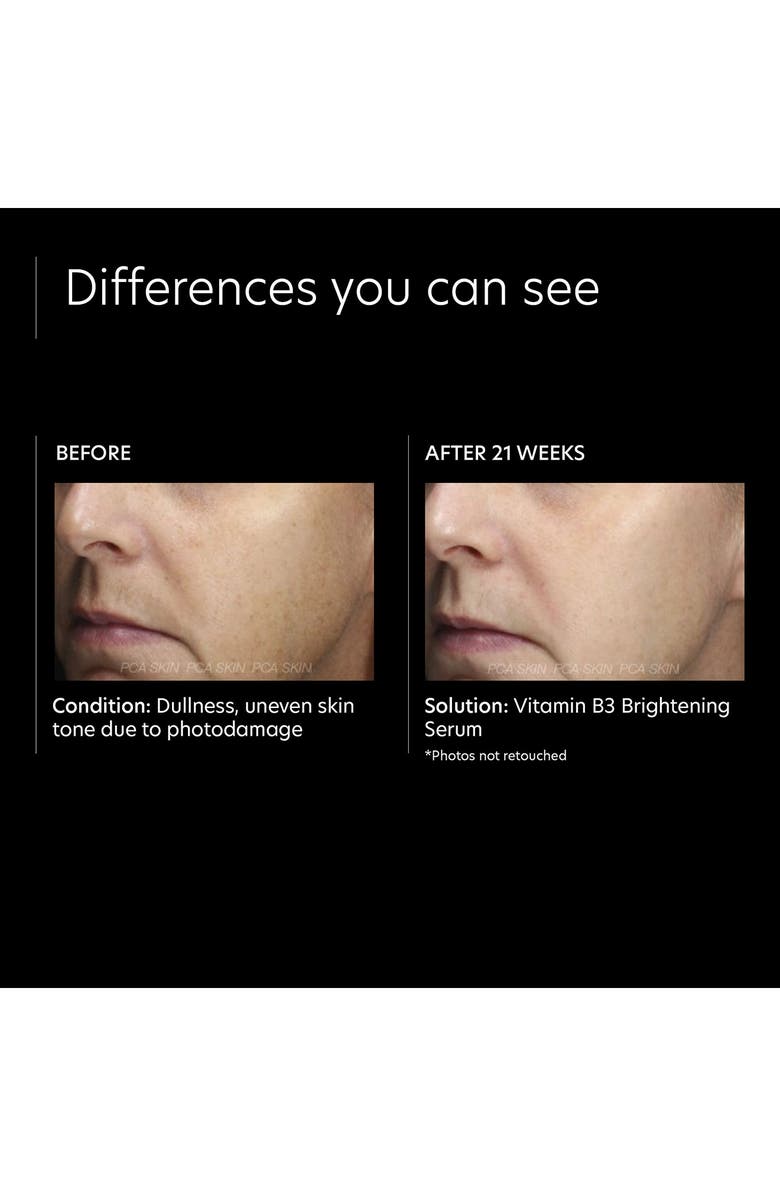 PCA Skin Vitamin B3 Brightening Serum, Alternate, color, 
