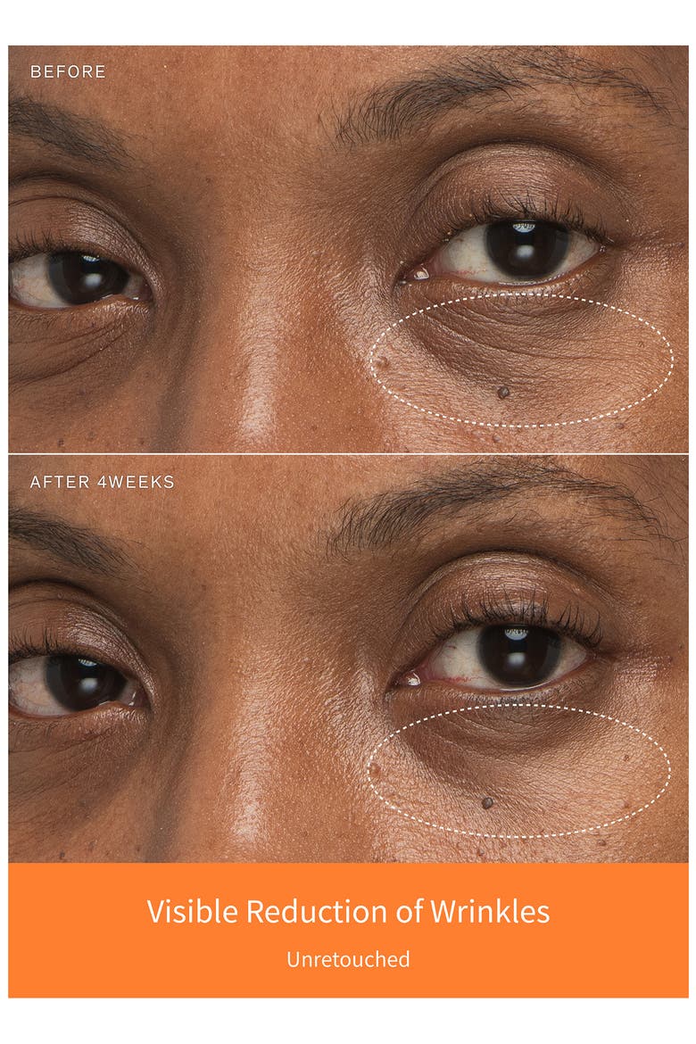 First Care Trial Set (Limited Edition) $86 Value, Alternate, color, NO COLOR