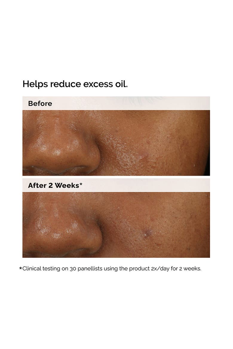 Balancing & Clarifying Serum for Oily Skin, Alternate, color, NO COLOR