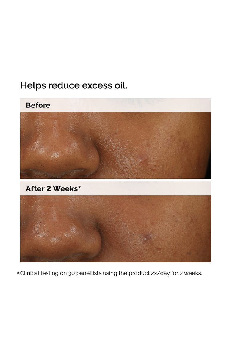 The Ordinary Balancing & Clarifying Serum for Oily Skin, Alternate, color, 