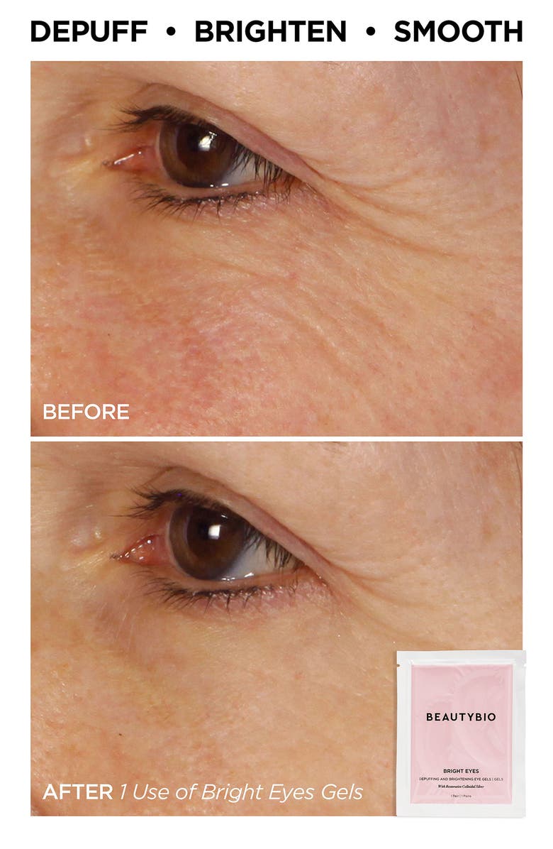 BeautyBio Glow & Go Essentials Set (Limited Edition) (Nordstrom Exclusive) $121 Value, Alternate, color, 