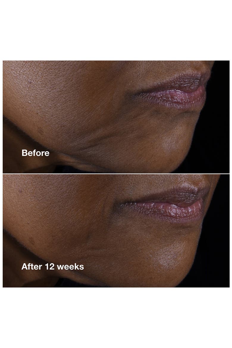 Smart Clinical Repair Lifting Face + Neck Cream, Alternate, color, NO COLOR