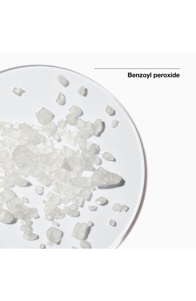 Clinique Acne Solutions All-Over Clearing Treatment, Alternate, color,