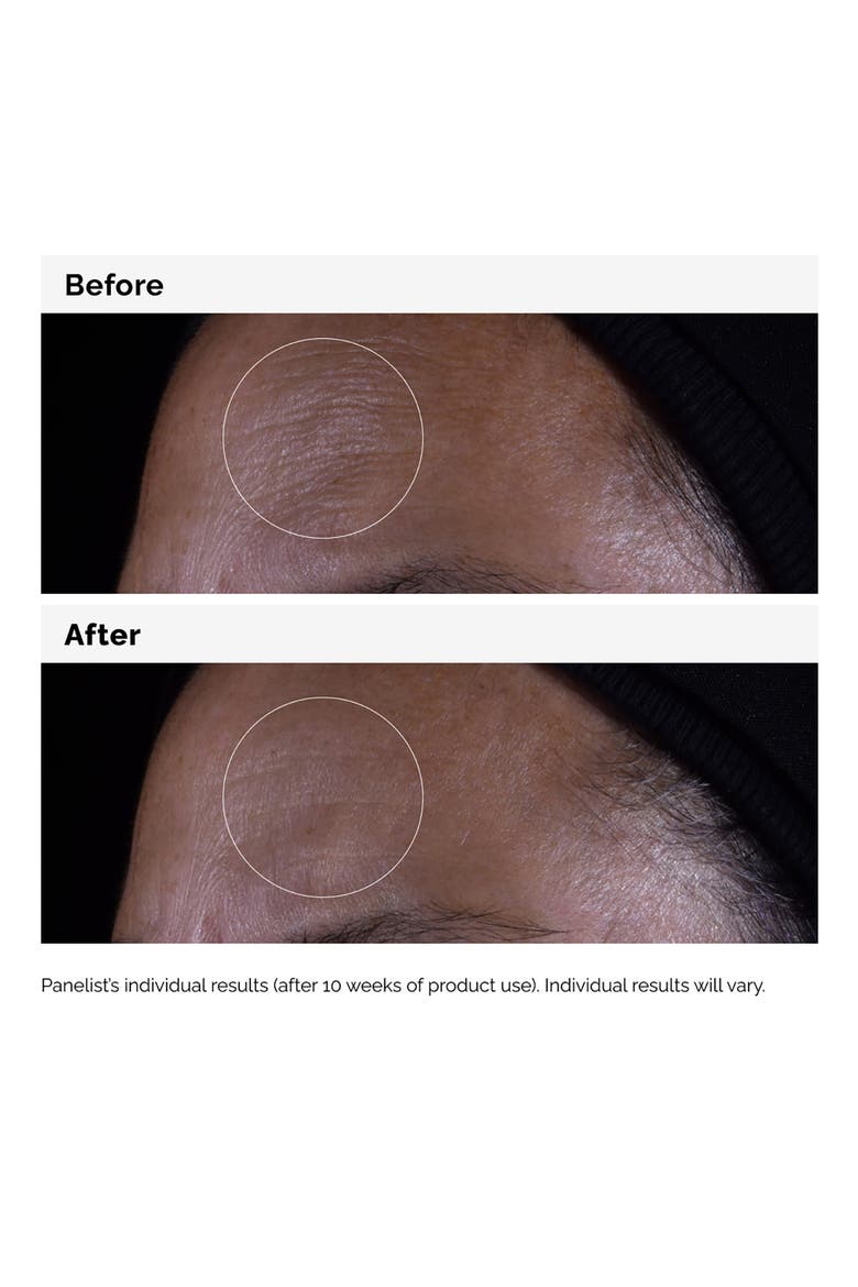 GF 15% Serum for Visible Skin Repair and Wrinkles, Alternate, color, NO COLOR