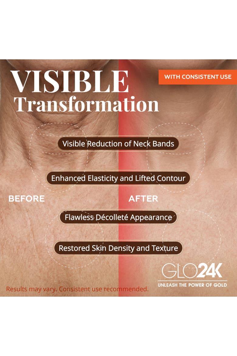 LED Neck Lift & V-Line Treatment Set, Alternate, color, BLACK