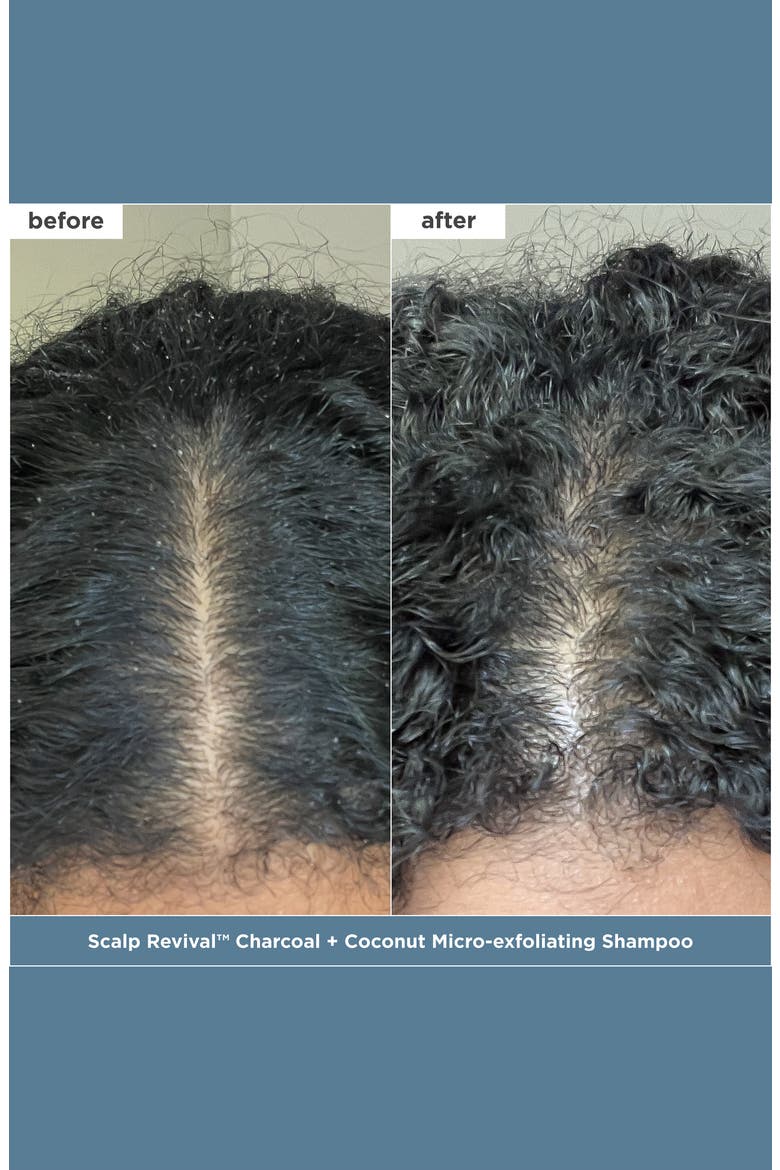 Scalp Revival™ + Don't Despair, Repair!™ Healthy Hair Delights Set, Alternate, color, NO COLOR