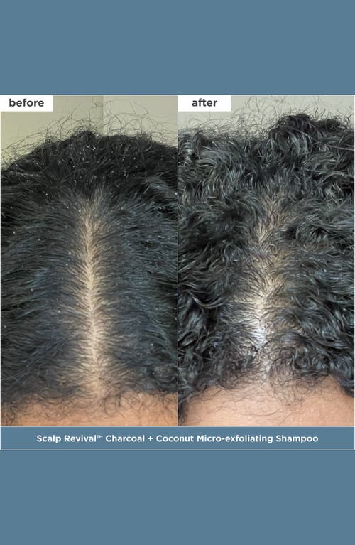 Briogeo Scalp Revival™ + Don't Despair, Repair!™ Healthy Hair Delights Set In Transparent