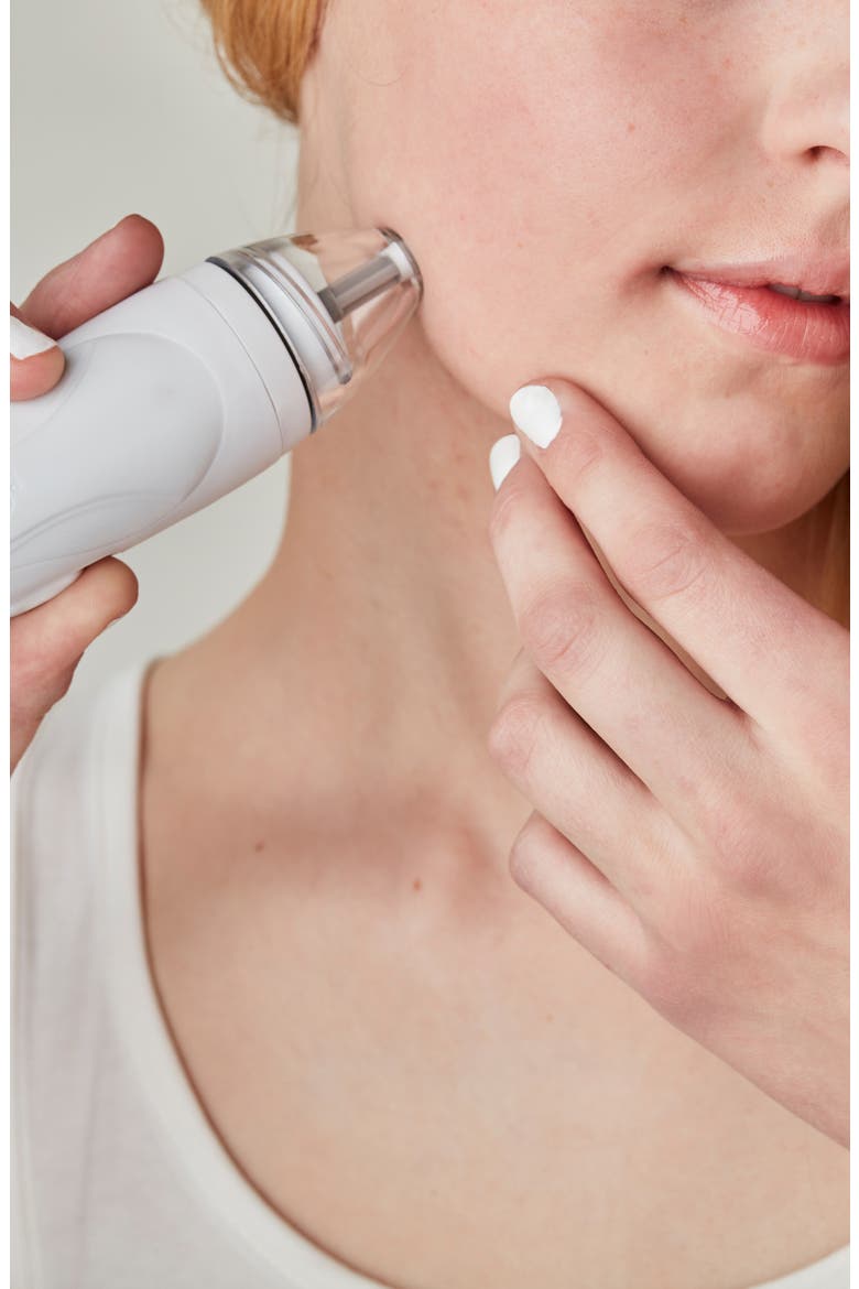 Personal Microderm Pro Exfoliation Device, Alternate, color, WHITE