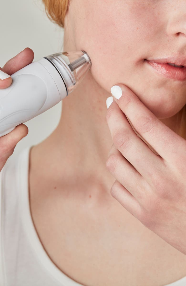 PMD Personal Microderm Pro Exfoliation Device, Alternate, color, White