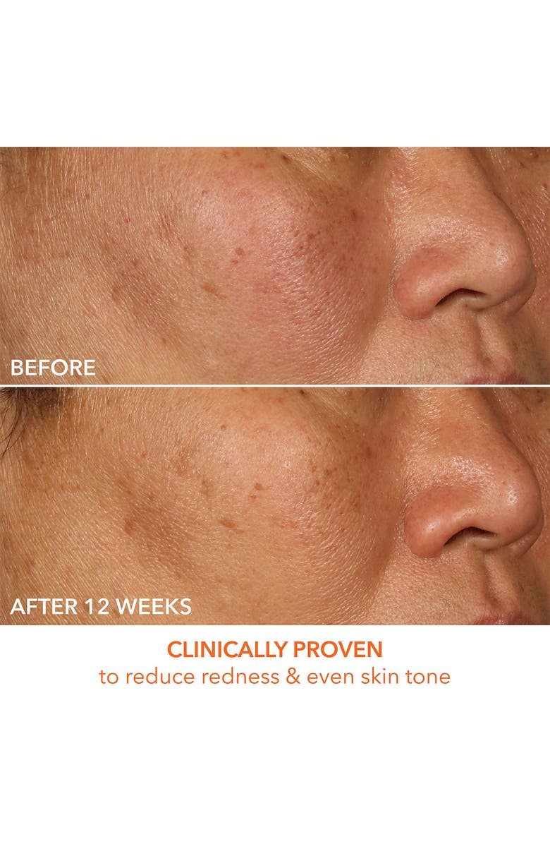 Dr. Dennis Gross Skincare Vitamin C Lactic 15% Firm & Bright Serum, Alternate, color, 