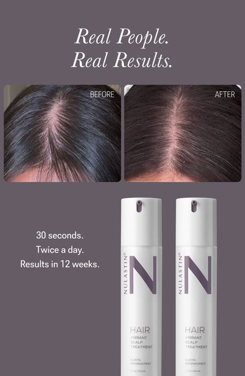 Nulastin Vibrant Scalp Treatment In White