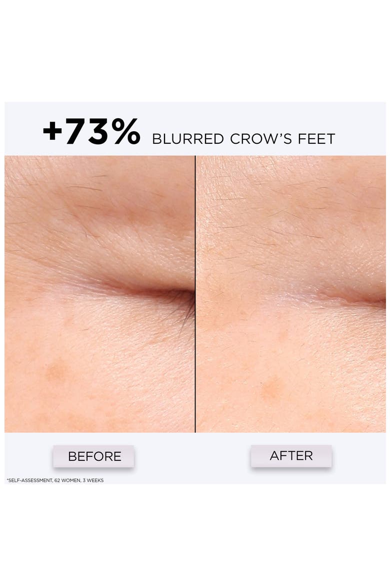 Génifique Repair Shot Multi-Wrinkle Corrector, Alternate, color, NO COLOR