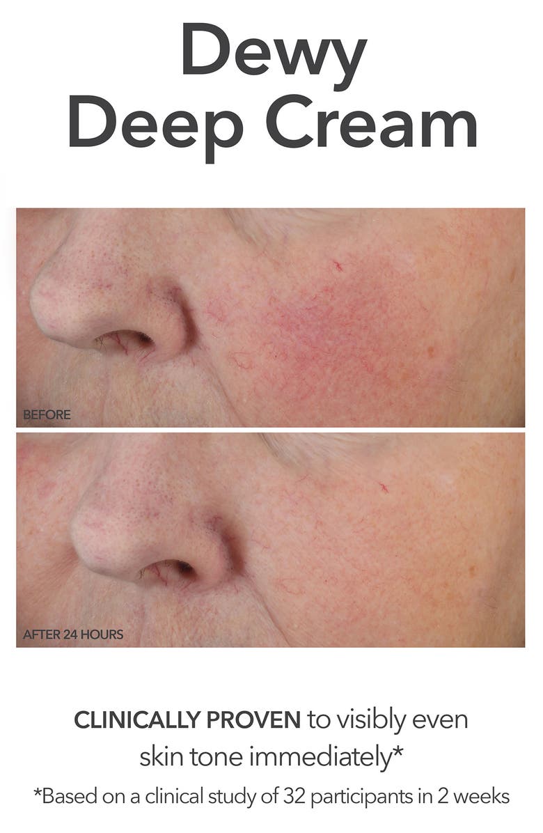 Dr. Dennis Gross Skincare Vitamin C Lactic Dewy Deep Cream Duo $154 Value, Alternate, color,