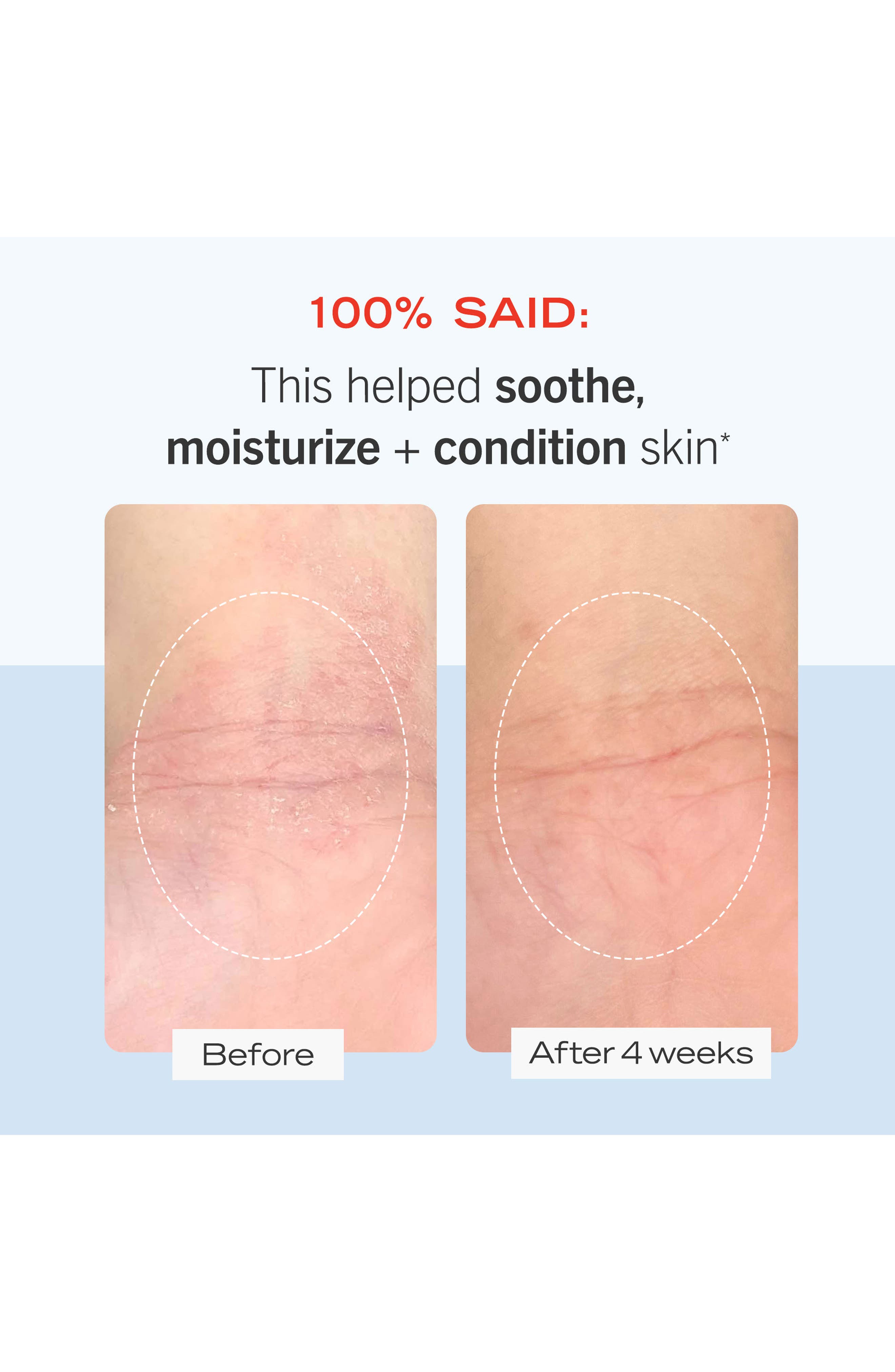 First Aid Beauty Sensitive Skin Starter Kit | Nordstromrack