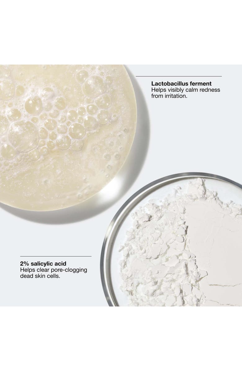 Clinique Acne Solutions Clinical Advanced Clearing Gel, Alternate, color,